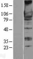 ARHGEF2 / GEF-H1 Protein - Western validation with an anti-DDK antibody * L: Control HEK293 lysate R: Over-expression lysate