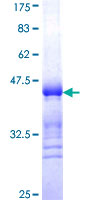 ARHGEF2 / GEF-H1 Protein - 12.5% SDS-PAGE Stained with Coomassie Blue.