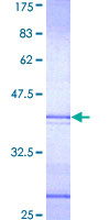 ARHGEF2 / GEF-H1 Protein - 12.5% SDS-PAGE Stained with Coomassie Blue.