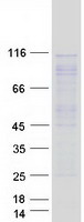 ARHGEF2 / GEF-H1 Protein - Purified recombinant protein ARHGEF2 was analyzed by SDS-PAGE gel and Coomassie Blue Staining