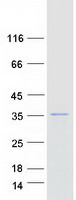 ARHGEF38 / FLJ20184 Protein - Purified recombinant protein ARHGEF38 was analyzed by SDS-PAGE gel and Coomassie Blue Staining