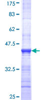 ARHGEF4 Protein - 12.5% SDS-PAGE Stained with Coomassie Blue.
