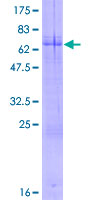 ARHGEF40 / SOLO Protein - 12.5% SDS-PAGE of human FLJ10357 stained with Coomassie Blue