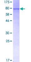 ARHGEF5 Protein - 12.5% SDS-PAGE of human ARHGEF5 stained with Coomassie Blue