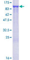 ARHGEF6 Protein - 12.5% SDS-PAGE of human ARHGEF6 stained with Coomassie Blue