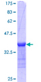 ARHGEF6 Protein - 12.5% SDS-PAGE Stained with Coomassie Blue.