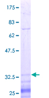 ARHGEF7 Protein - 12.5% SDS-PAGE Stained with Coomassie Blue.