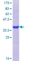 ARHGEF9 / Collybistin Protein - 12.5% SDS-PAGE Stained with Coomassie Blue.