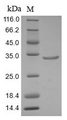 ARID1A / BAF250 Protein - (Tris-Glycine gel) Discontinuous SDS-PAGE (reduced) with 5% enrichment gel and 15% separation gel.