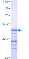 ARID1B / BAF250B Protein - 12.5% SDS-PAGE Stained with Coomassie Blue.