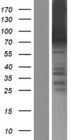 ARID3B Protein - Western validation with an anti-DDK antibody * L: Control HEK293 lysate R: Over-expression lysate