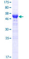 ARID3B Protein - 12.5% SDS-PAGE of human ARID3B stained with Coomassie Blue