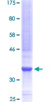 ARID5B Protein - 12.5% SDS-PAGE Stained with Coomassie Blue.