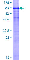 ARIH2 Protein - 12.5% SDS-PAGE of human ARIH2 stained with Coomassie Blue