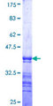Arkadia / RNF111 Protein - 12.5% SDS-PAGE Stained with Coomassie Blue.