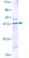 ARL1 Protein - 12.5% SDS-PAGE of human ARL1 stained with Coomassie Blue