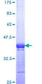 ARL1 Protein - 12.5% SDS-PAGE Stained with Coomassie Blue.