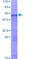 ARL10 Protein - 12.5% SDS-PAGE of human ARL10 stained with Coomassie Blue