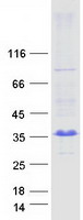 ARL10 Protein - Purified recombinant protein ARL10 was analyzed by SDS-PAGE gel and Coomassie Blue Staining