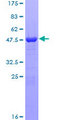 ARL11 Protein - 12.5% SDS-PAGE of human ARL11 stained with Coomassie Blue