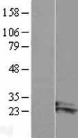 ARL14 Protein - Western validation with an anti-DDK antibody * L: Control HEK293 lysate R: Over-expression lysate