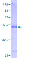 ARL14 Protein - 12.5% SDS-PAGE of human FLJ22595 stained with Coomassie Blue