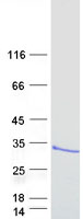 ARL14 Protein - Purified recombinant protein ARL14 was analyzed by SDS-PAGE gel and Coomassie Blue Staining