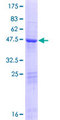 ARL15 Protein - 12.5% SDS-PAGE of human ARL15 stained with Coomassie Blue