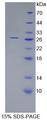 ARL15 Protein - Recombinant  ADP Ribosylation Factor Like Protein 15 By SDS-PAGE