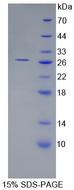 ARL15 Protein - Recombinant  ADP Ribosylation Factor Like Protein 15 By SDS-PAGE