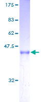 ARL2BP / BART Protein - 12.5% SDS-PAGE of human ARL2BP stained with Coomassie Blue