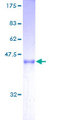 ARL2BP / BART Protein - 12.5% SDS-PAGE of human ARL2BP stained with Coomassie Blue