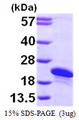 ARL2BP / BART Protein