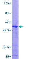 ARL4D Protein - 12.5% SDS-PAGE of human ARL4D stained with Coomassie Blue