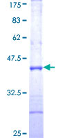ARL4D Protein - 12.5% SDS-PAGE Stained with Coomassie Blue.
