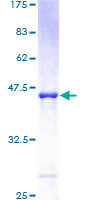ARL5A / ARL5 Protein - 12.5% SDS-PAGE of human ARL5 stained with Coomassie Blue