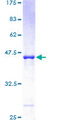 ARL5A / ARL5 Protein - 12.5% SDS-PAGE of human ARL5 stained with Coomassie Blue