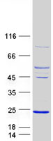 ARL5A / ARL5 Protein - Purified recombinant protein ARL5A was analyzed by SDS-PAGE gel and Coomassie Blue Staining