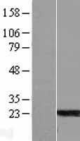 ARL6 Protein - Western validation with an anti-DDK antibody * L: Control HEK293 lysate R: Over-expression lysate