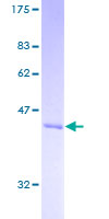 ARL6 Protein - 12.5% SDS-PAGE of human ARL6 stained with Coomassie Blue