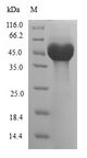 ARL6 Protein - (Tris-Glycine gel) Discontinuous SDS-PAGE (reduced) with 5% enrichment gel and 15% separation gel.
