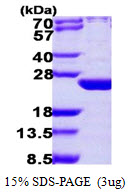ARL6 Protein