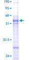 ARL6IP1 / ARMER Protein - 12.5% SDS-PAGE of human ARL6IP stained with Coomassie Blue
