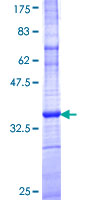 ARL6IP5 Protein - 12.5% SDS-PAGE Stained with Coomassie Blue.