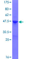 ARL8 / ARL5B Protein - 12.5% SDS-PAGE of human ARL5B stained with Coomassie Blue