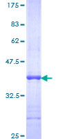 ARL8 / ARL5B Protein - 12.5% SDS-PAGE Stained with Coomassie Blue.