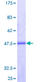 ARL8A Protein - 12.5% SDS-PAGE of human ARL8A stained with Coomassie Blue