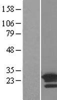 ARL8B Protein - Western validation with an anti-DDK antibody * L: Control HEK293 lysate R: Over-expression lysate