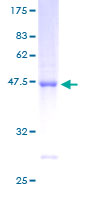 ARL8B Protein - 12.5% SDS-PAGE of human ARL10C stained with Coomassie Blue