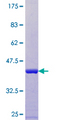 ARL9 Protein - 12.5% SDS-PAGE of human ARL9 stained with Coomassie Blue